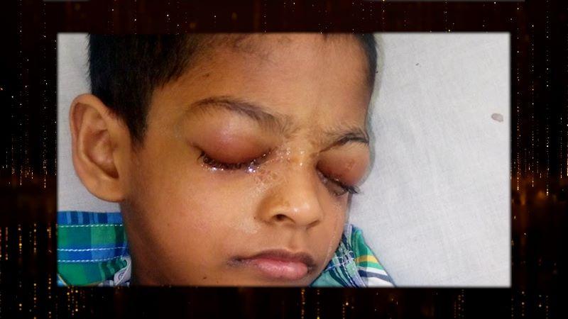 މަފާޒްގެ ފަރުވާގެ ދެން އޮތީ ފަހުމަރުހަލާ، ޑޮކްޓަރުން ވިދާޅުވަނީ ލަސްކޮށްފިއްޔާ އަނެއްކާވެސް ގޯސްވެދާނެ ކަމަށް